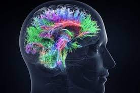 CEREBRO